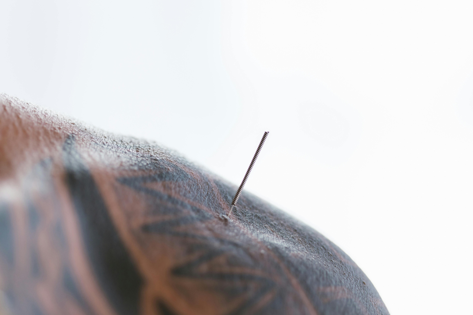 Descubre con Fisioterapia TMR Torrevieja la diferencia entre punción seca y acupuntura. Aprende cómo actúan estas técnicas con agujas, cuándo se utilizan y cuál puede ayudarte más según tu lesión o tipo de dolor.
